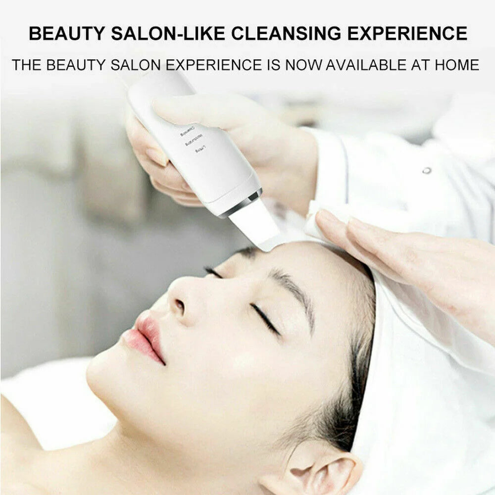 Ultrasonic Facial Skin Scrubber & Deep Pore Cleanser Spatula - AmaraKin Nursery & Family Essentials (Photo 1)